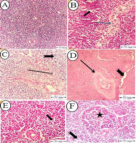 Photomicrograph Showing Histopathological Changes Of Spleen Tissues Of