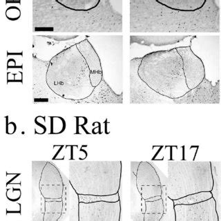 Photomicrographs Of The CFOS Expression At Zeitgeber Time 5 And 17 In