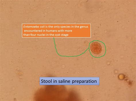 Entamoeba Coli Introduction Clinical Presentationlife Cycle Lab Diagnosis