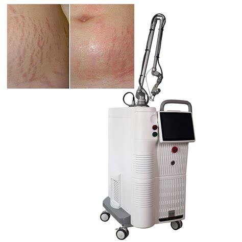 Omanli Co2 Fractional Laser Machine Vaginal Tightening Freckles Stretch Mark Removal Equipment