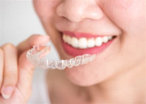 Cada cuánto tiempo se cambian las fundas de Invisalign