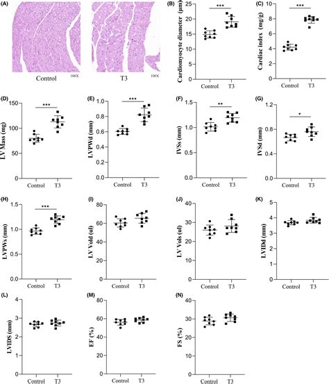 High Triiodothyronine Levels Induce Myocardial Hypertrophy Via Baff