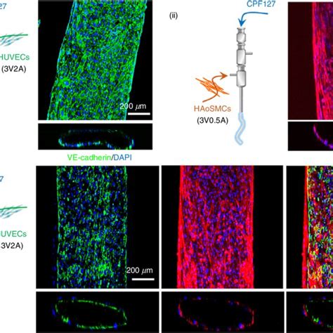 Pdf Tissue Engineering Of Vascular Grafts Containing Endothelium And