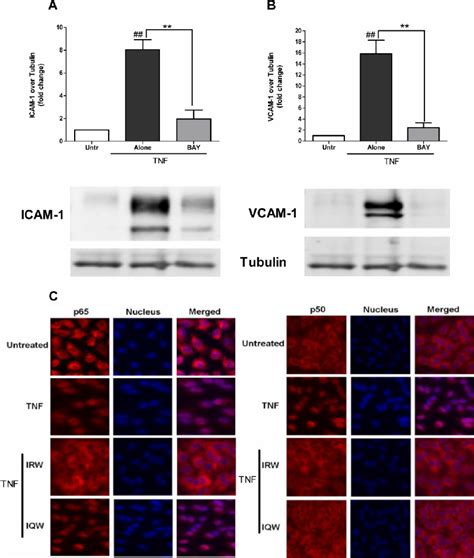 Role Of Irw And Iqw On Tnf Induced Nf B Activation A Con Fl Uent