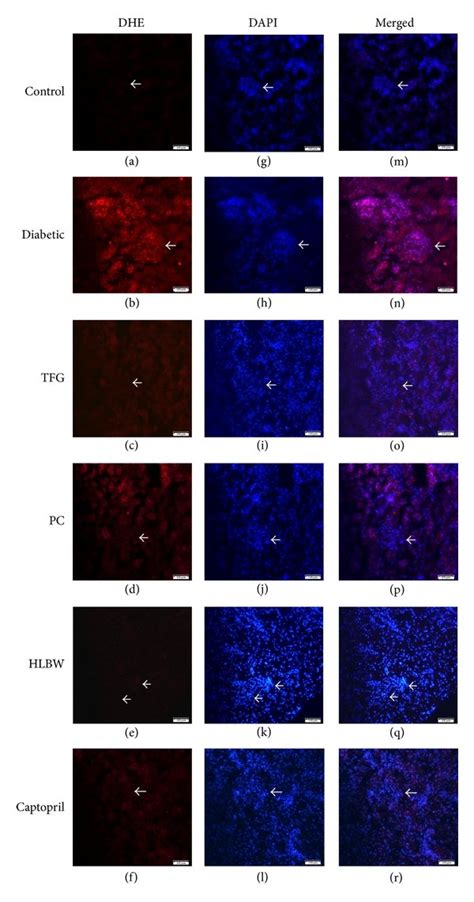 Dihydroethidium Staining In The Glomeruli From The Rats In Different