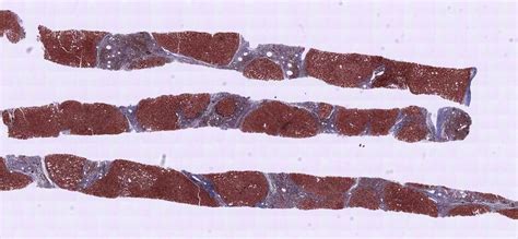 Top Tips Regarding Eus Guided Liver Biopsy Gastrointestinal Endoscopy