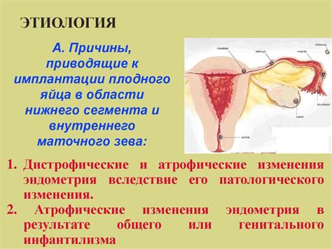 Акушерские кровотечения во время беременности. Оказание неотложной ...