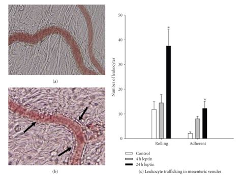 Leukocyte Trafficking In The Mesenteric Microvasculature Wistar Rats