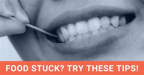 Food Stuck Between Teeth Try These 8 Helpful Tips