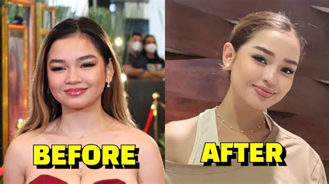 Xyriel Manabat On Plastic Surgery YouTube