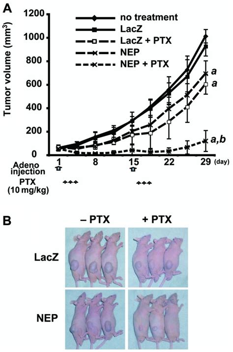 Adnep Infection Plus Paclitaxel Inhibits Du145 Xenograft Tumor Growth