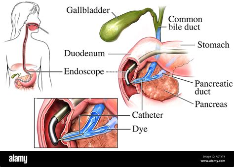 Cholangiography Procedure 51 OFF Micoope Gt