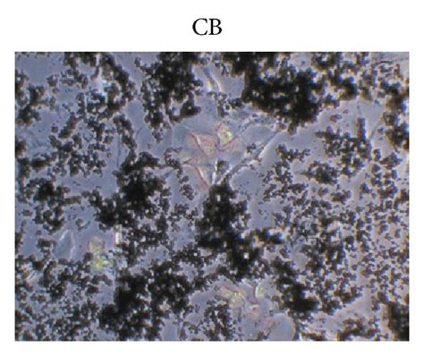 Phase Contrast Micrographs Showing A549 Cell Cultures A Untreated