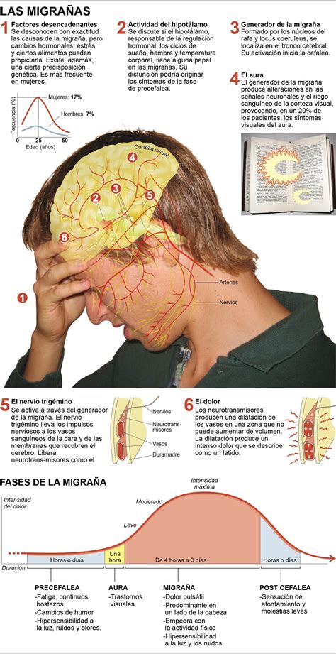 Migra A Revista Medical Technology Migraine Health And Nutrition