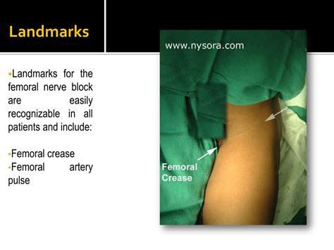 Ppt Lumbar Plexus Block And Femoral Nerve Block Powerpoint Presentation