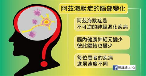 腦退化｜常迷路突然邋遢腦退化症6特徵 冇藥醫2種生活習慣最重要｜醫師easy