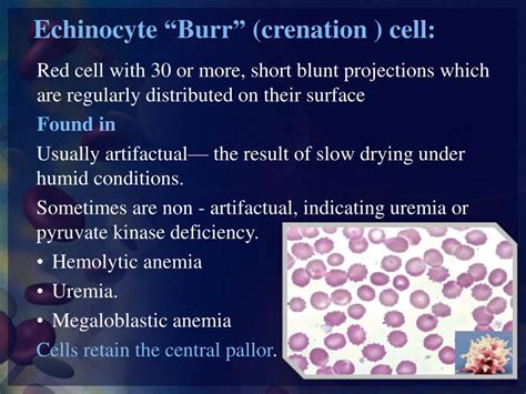 Ppt Rbc’s Morphology Powerpoint Presentation Free Download Id 2241450