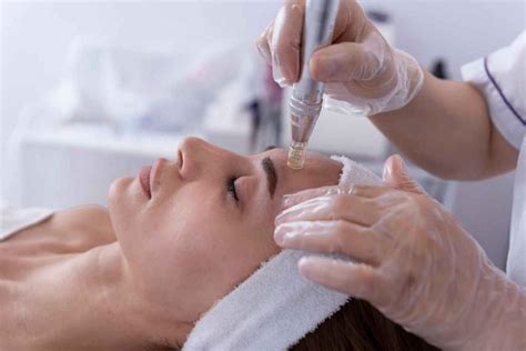 Microneedling Benefits Skin Rejuvenation At Its Finest Cosmedoctor