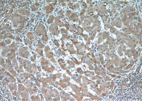 Alpha-2-macroglobulin Rabbit Polyclonal antibody