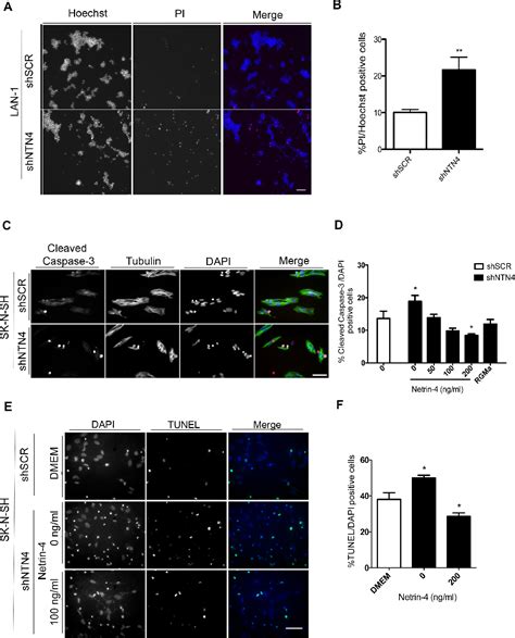 Pdf The Netrin Neogenin Axis Promotes Neuroblastoma Cell