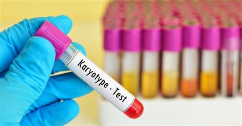 Karyotype Test: Types, Uses Purpose, Procedure and Results