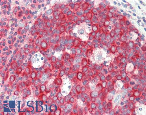 IHC Plus RPL4 Ribosomal Protein L4 Monoclonal Antibody Mouse LSBio