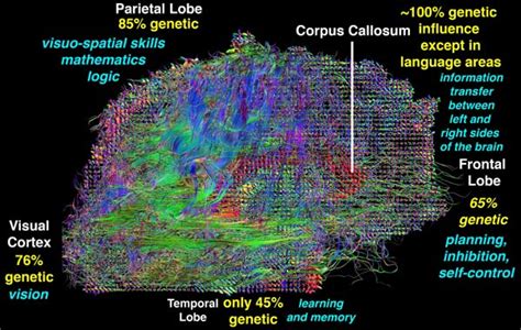 Brain Images Reveal The Secret To Higher Iq Mit Technology Review