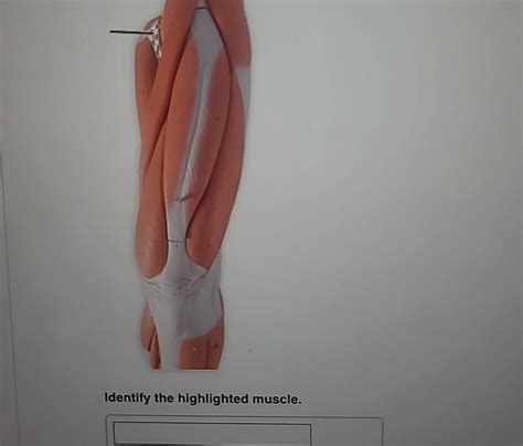 Solved Identify The Highlighted Muscle Chegg