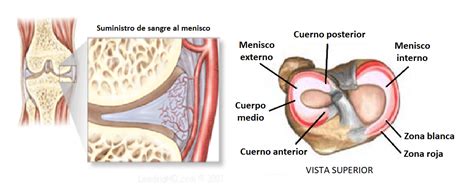 Rotura De Menisco Qu Es Causas S Ntomas Tratamiento Y Consejos