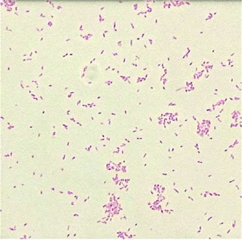 Gram Negative Coccobacillus