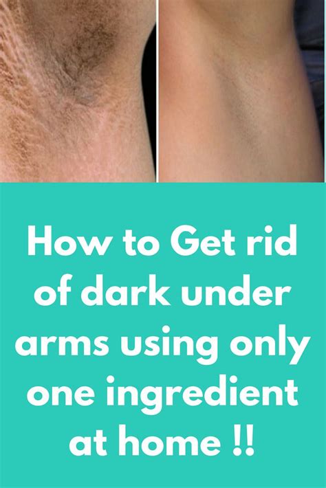 One Week Challenge To Get Rid Of Dark Under Arms Using Only One