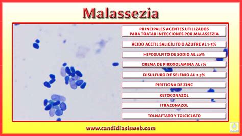 ¿qué Es Malassezia