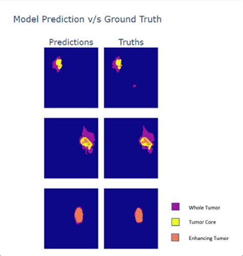 Figure E Prediction Vs Ground Truth Segmentation Mask Comparison