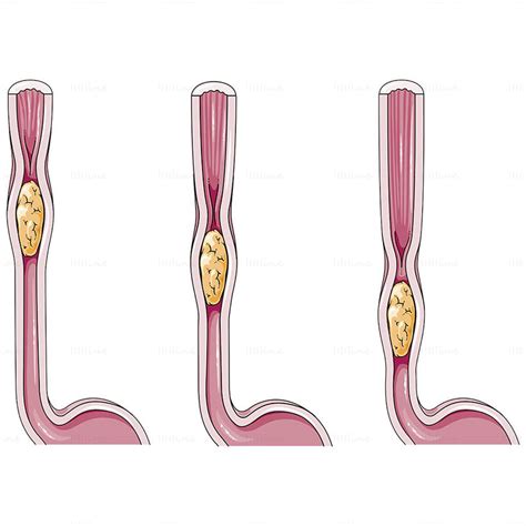 Peristalsis Of The Intestines Vector Biology Facts Ppt It Works Save