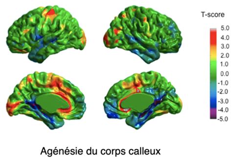 Cours 2 Méthodes en neuropsychologie Flashcards Quizlet