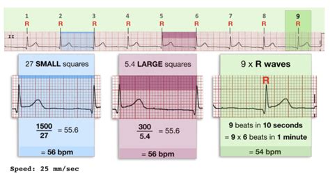 Fast Lane ECG Logo