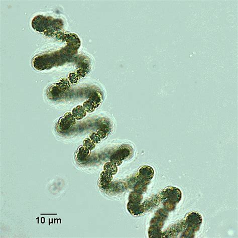 Environmentalists Monitor Cyanobacteria To Protect Cape Cods