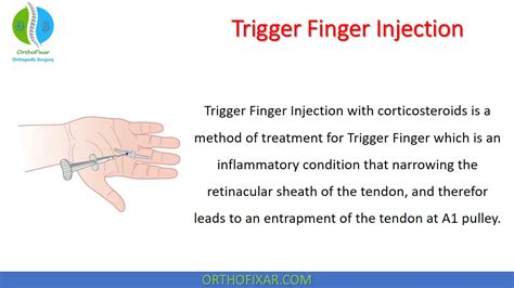 Trigger Finger Injection | OrthoFixar 2025