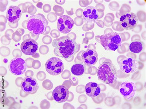 White Blood Cells In Peripheral Blood Smear Wright Stain Stock 사진