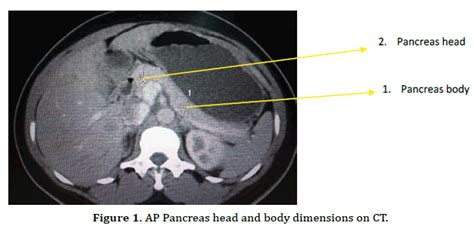 Correlation of Ultrasound and Computed Tomography Measurements of