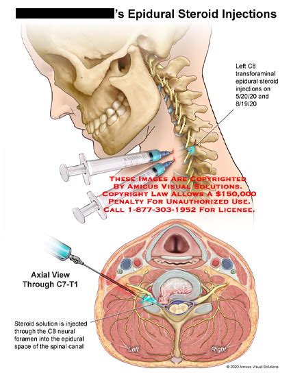 Medical Exhibits Demonstrative Aids Illustrations And Models