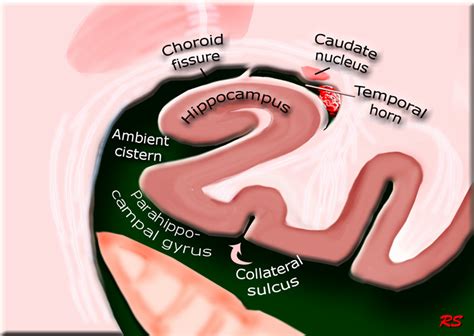 Hippo Campus Anatomy Radiology