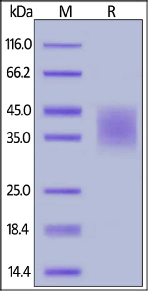 Acrobiosystems Acrobiosystems Biotinylated Human Pd L B Dc Protein