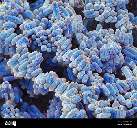 E Coli Bakterien Farbige Scanning Electron Micrograph Sem Von Escherichia Coli Bakterien E