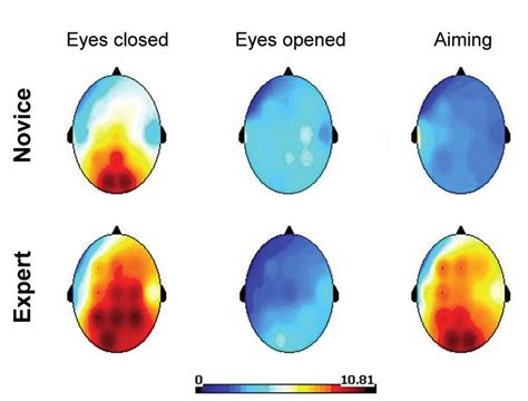 Topographical Maps Of Mean Amplitudes Of The Spectrum Of The Total