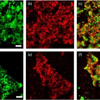 Localization Of PDL1 Into Raft Enriched Regions Assessed By TIRF