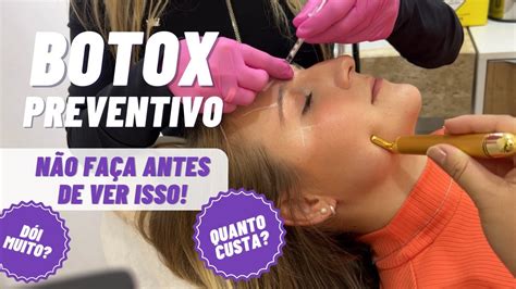 Revelado O Verdadeiro Pre O Do Botox Na Testa Passo A Passo Dicas