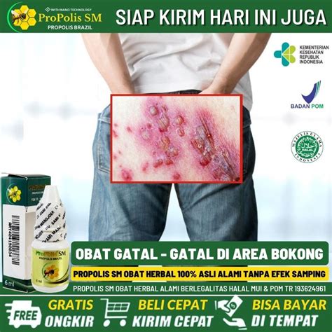 Jual Salep Borok Bernanah Di Pantat Selangkangan Paha Obat