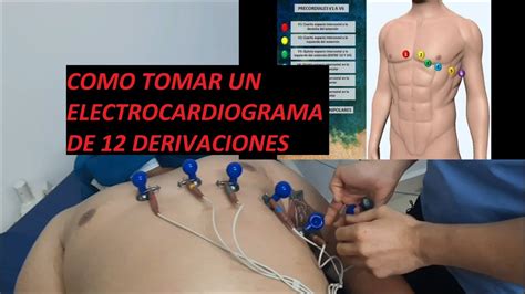 Como Tomar Un Electrocardiograma De 12 Derivaciones YouTube