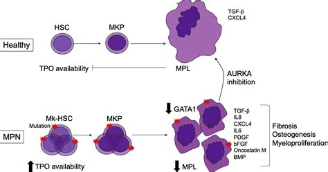 The Role Of Megakaryocytes In Myelofibrosis Hematology Oncology Clinics